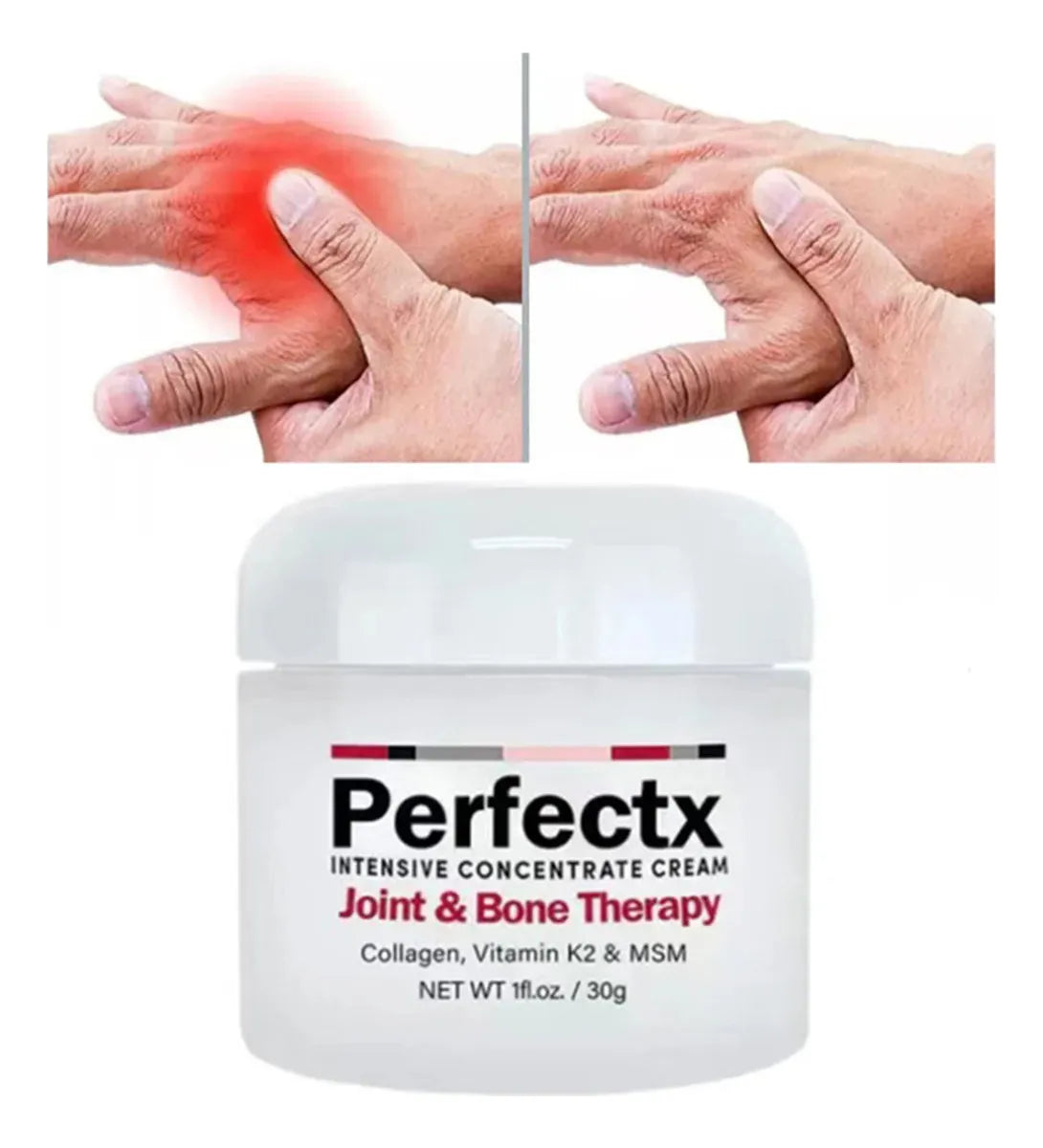 PerfectX™ – La crema natural que devuelve la movilidad a tus articulaciones en 15 minutos