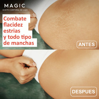 HydraDeep Magic™ – El aceite que restaura la hidratación profunda que tu piel perdió hace años